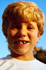 Fotografía de un niño pequeño al que se le cayo su diente de delante