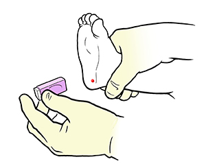 Vista inferior del pie de un bebé donde se observan las zonas para la punción en el talón. La zona verde indica la parte que se usa de la planta del pie. Manos con guantes sosteniendo una lanceta contra el talón del bebé.